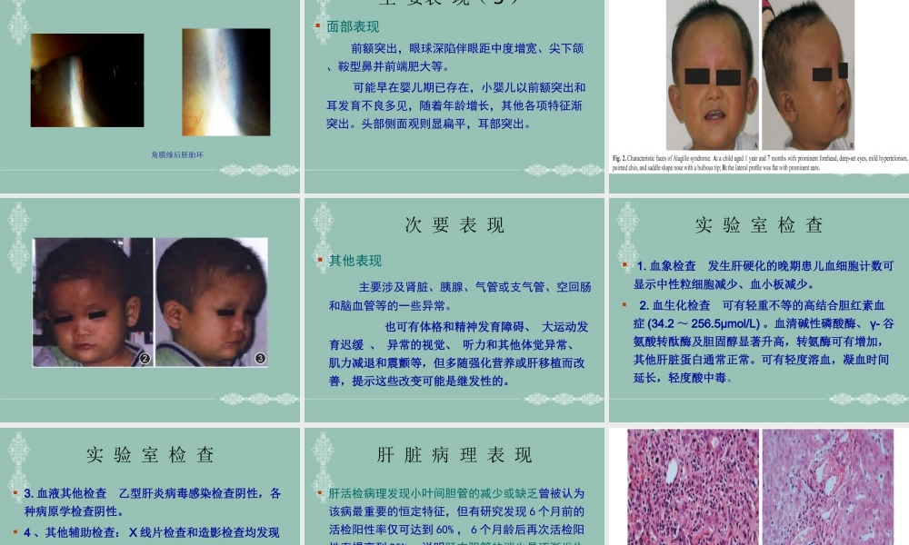 A综合征医学优质PPT课件