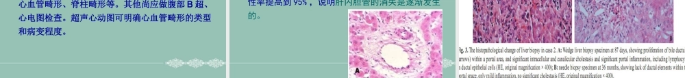 A综合征医学优质PPT课件