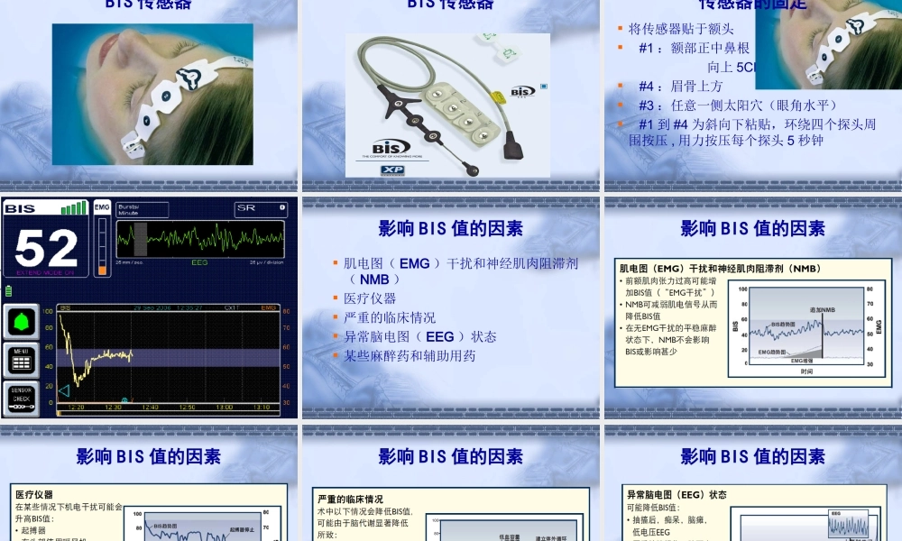 BIS监测PPT专业课件