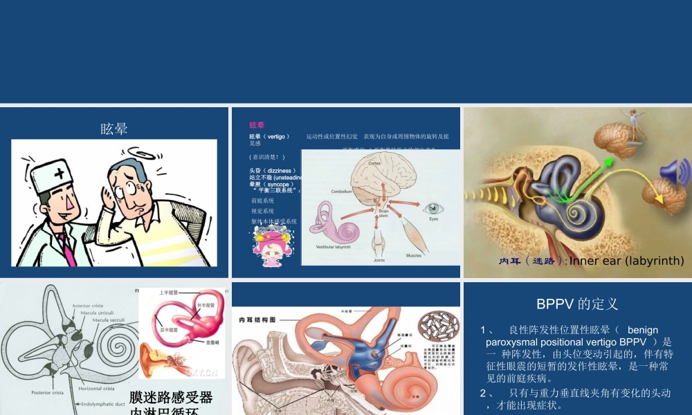 BPPV的诊断与治疗优质PPT课件