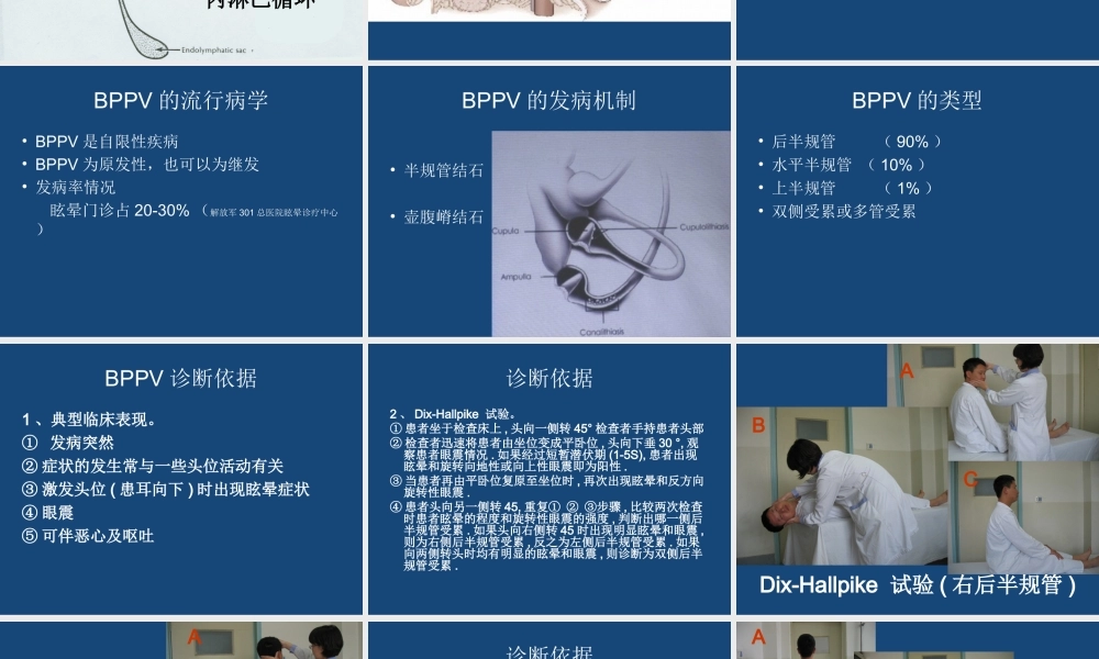 BPPV的诊断与治疗优质PPT课件