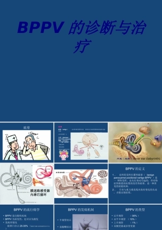 BPPV的诊断与治疗优质PPT课件