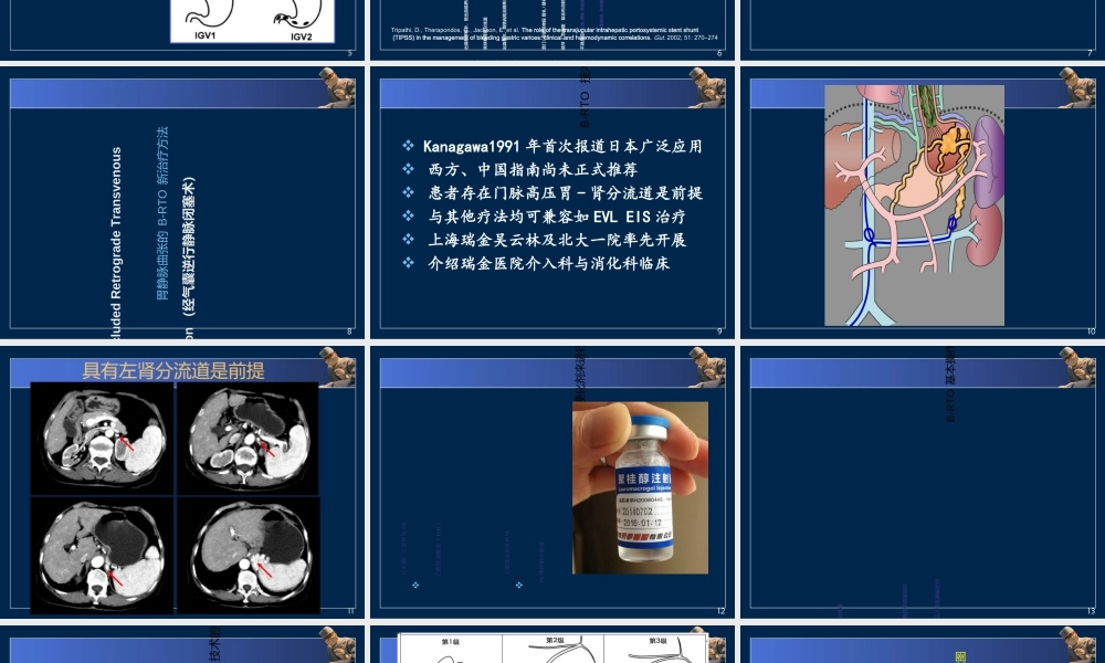 BRTO治疗胃底静脉曲张医学知识讲解讲义