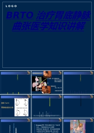 BRTO治疗胃底静脉曲张医学知识讲解讲义