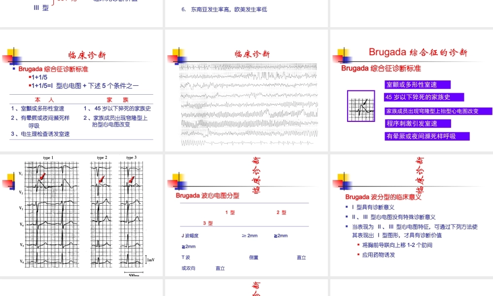 B综合征的临床诊疗优质PPT课件