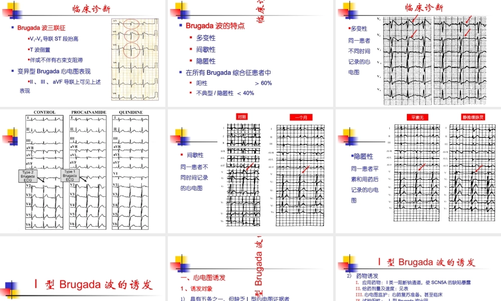B综合征的临床诊疗优质PPT课件