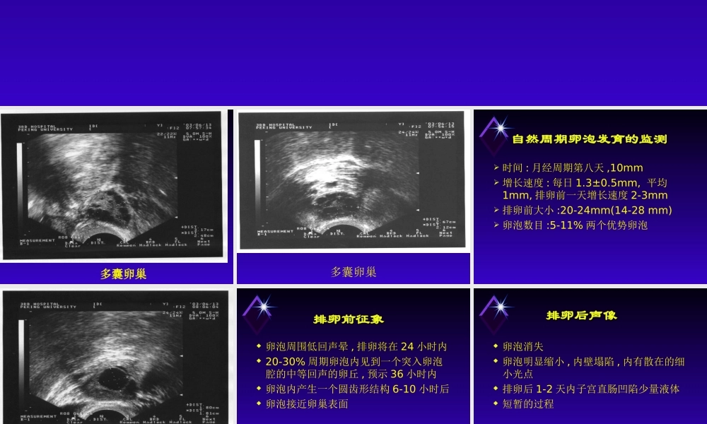 B超监测卵泡发育-医学课件