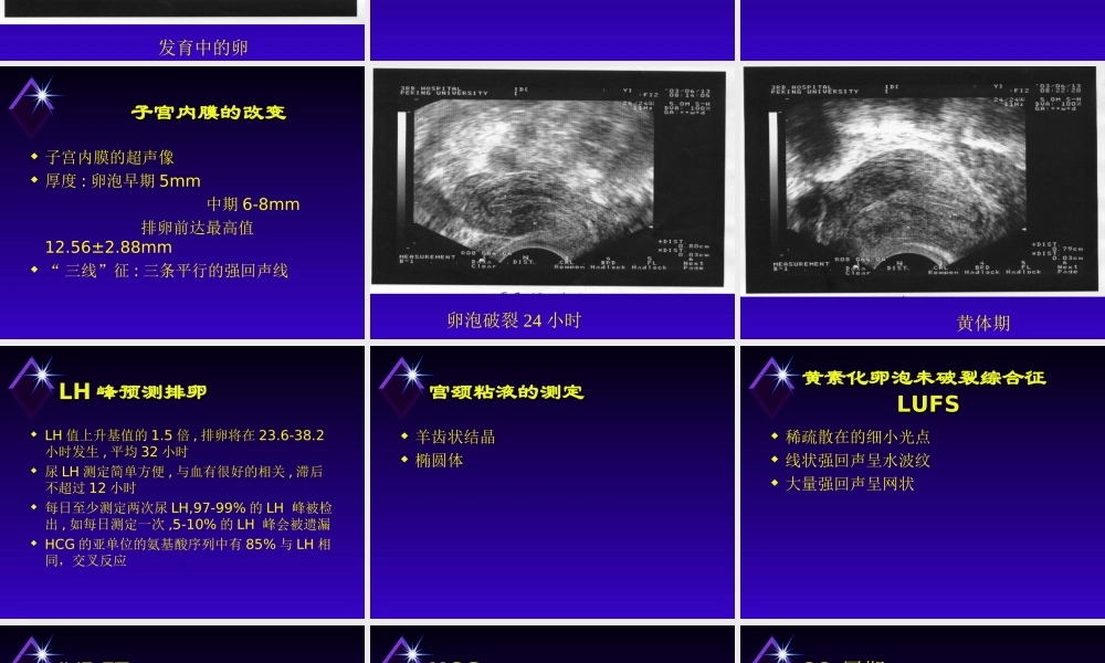 B超监测卵泡发育-医学课件