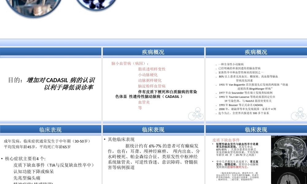 CADASIL诊断治疗医学知识讲解讲义