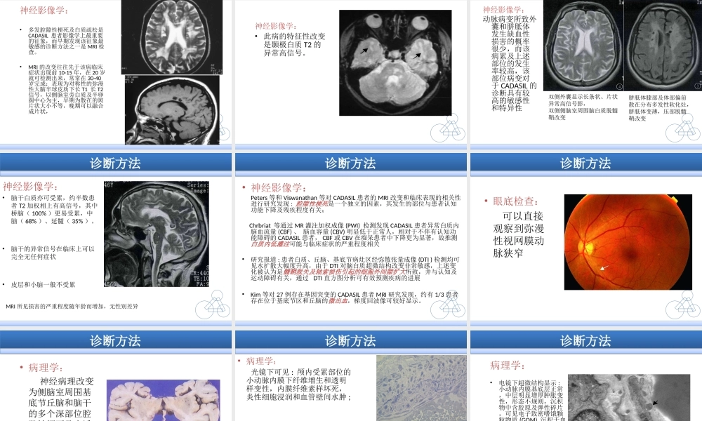 CADASIL诊断治疗医学知识讲解讲义