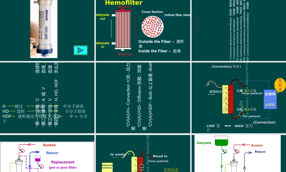 CRRT原理及治疗模式优质PPT课件