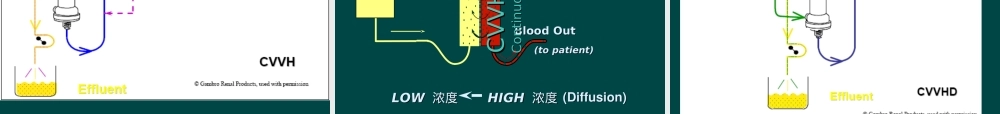 CRRT原理及治疗模式优质PPT课件