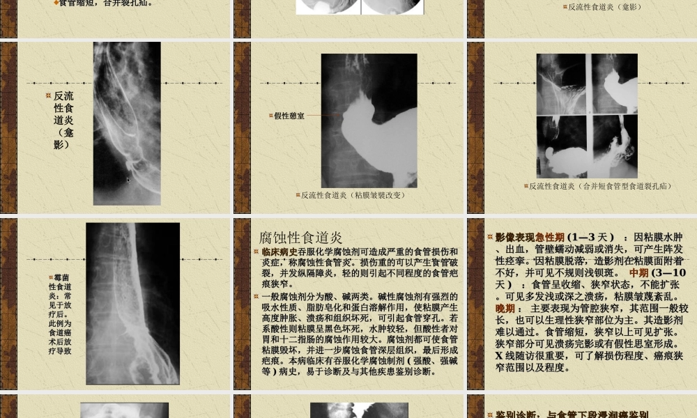 CT学习食道病变优质PPT课件