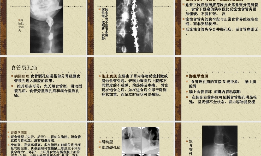 CT学习食道病变优质PPT课件