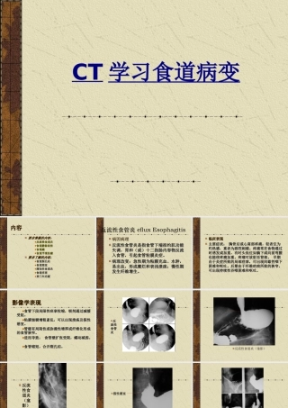 CT学习食道病变优质PPT课件