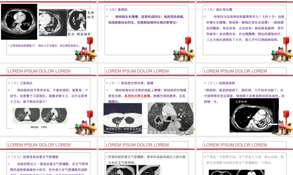 CT诊断肺结核PPT培训课件