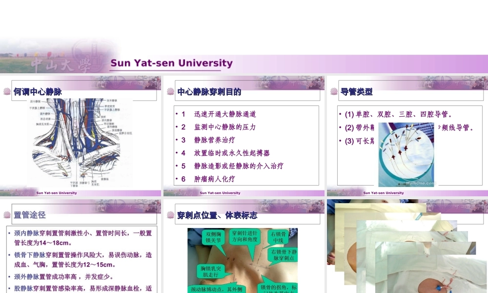 CVC置管与护理专题医学知识宣讲医学知识讲解讲义