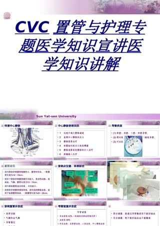 CVC置管与护理专题医学知识宣讲医学知识讲解讲义