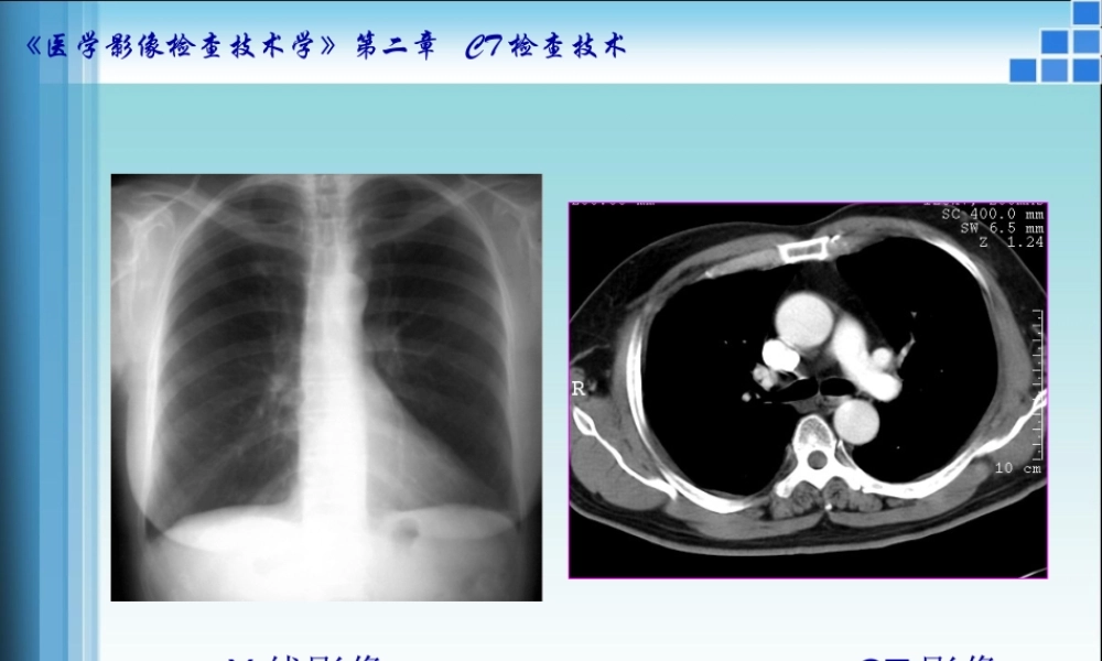 CT检查技术方法-医学课件
