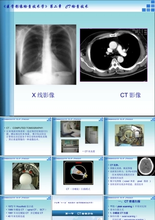 CT检查技术方法-医学课件