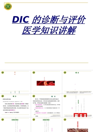 DIC的诊断与评价医学知识讲解讲义