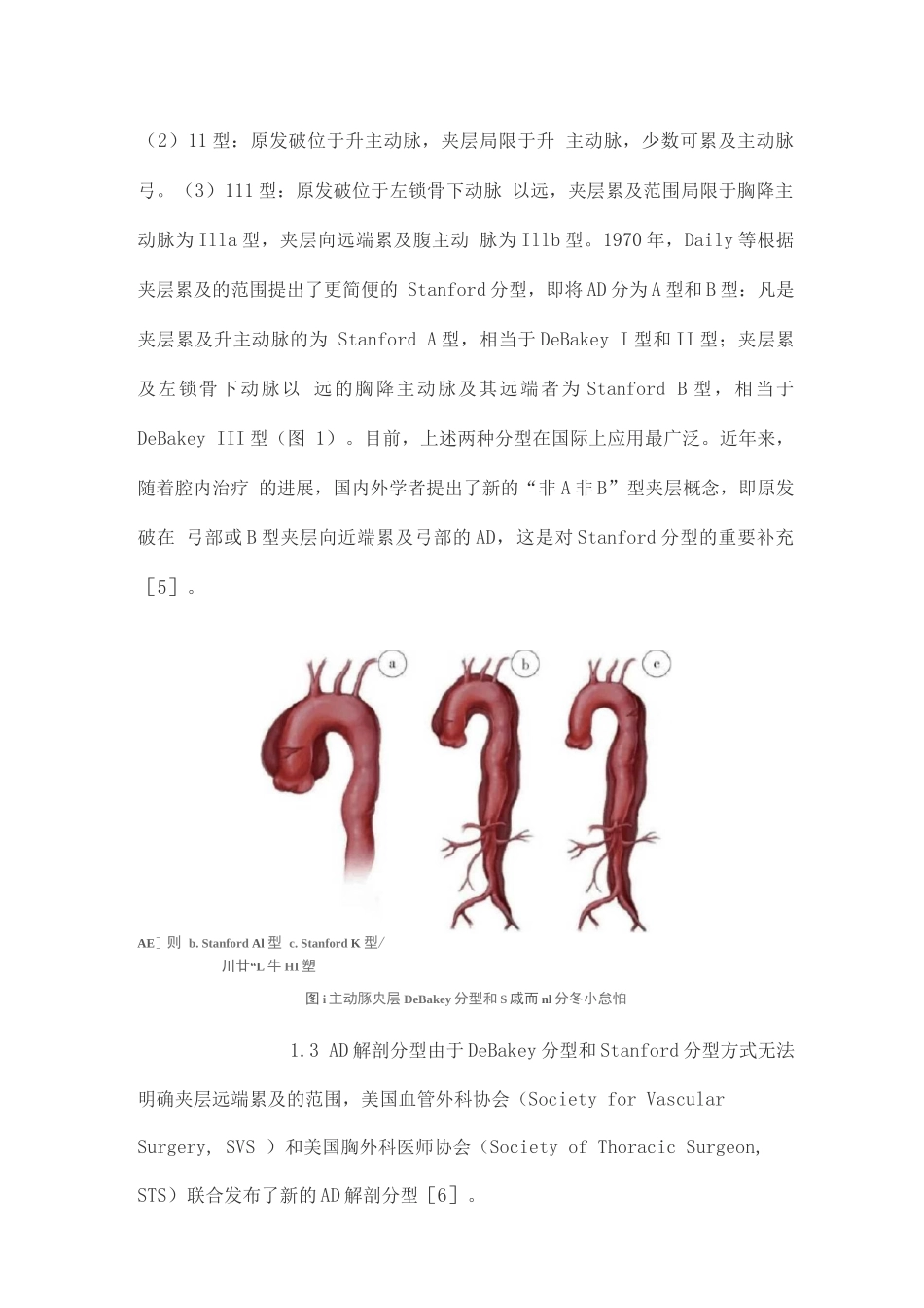 StanfordB型主动脉夹层诊断和治疗中国专家共识_第2页