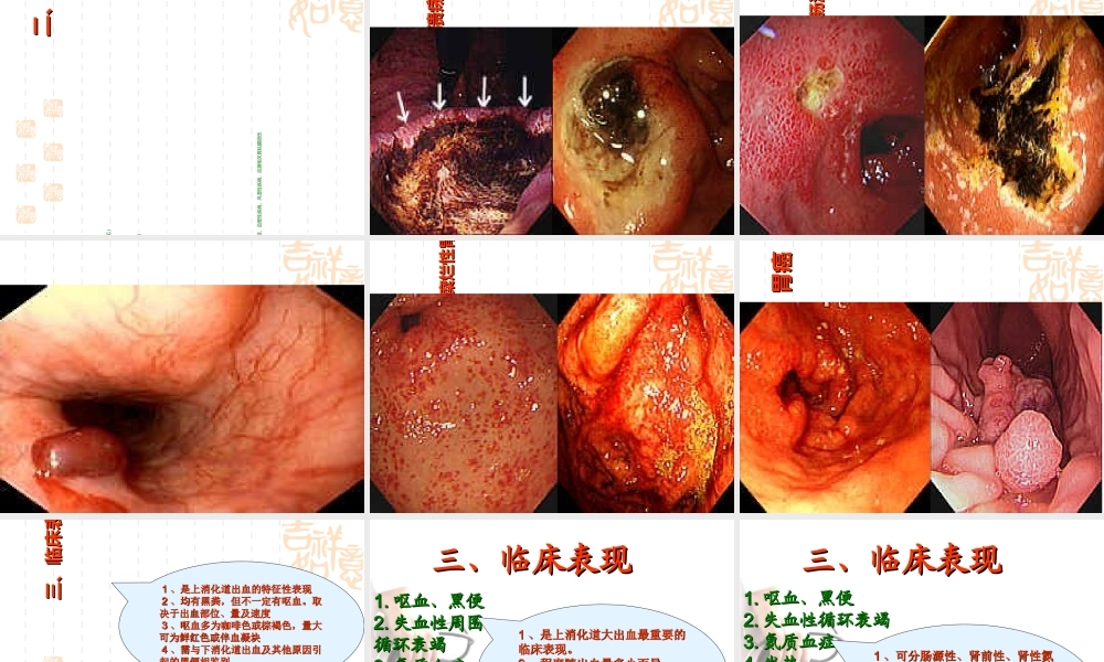 上消化道出血的查房