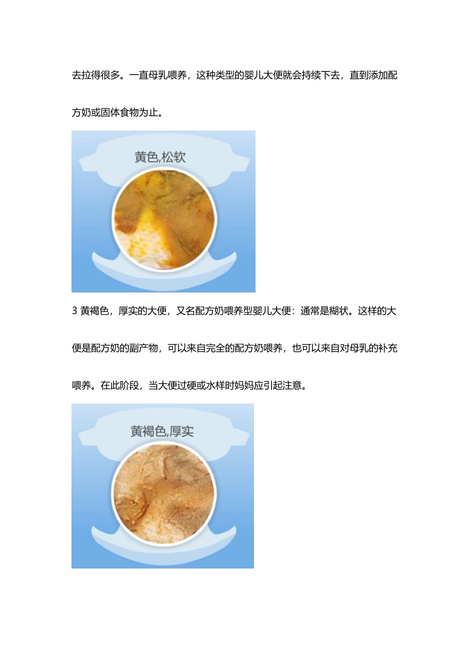 两个月宝宝大便-婴儿大便十二种性状_第3页