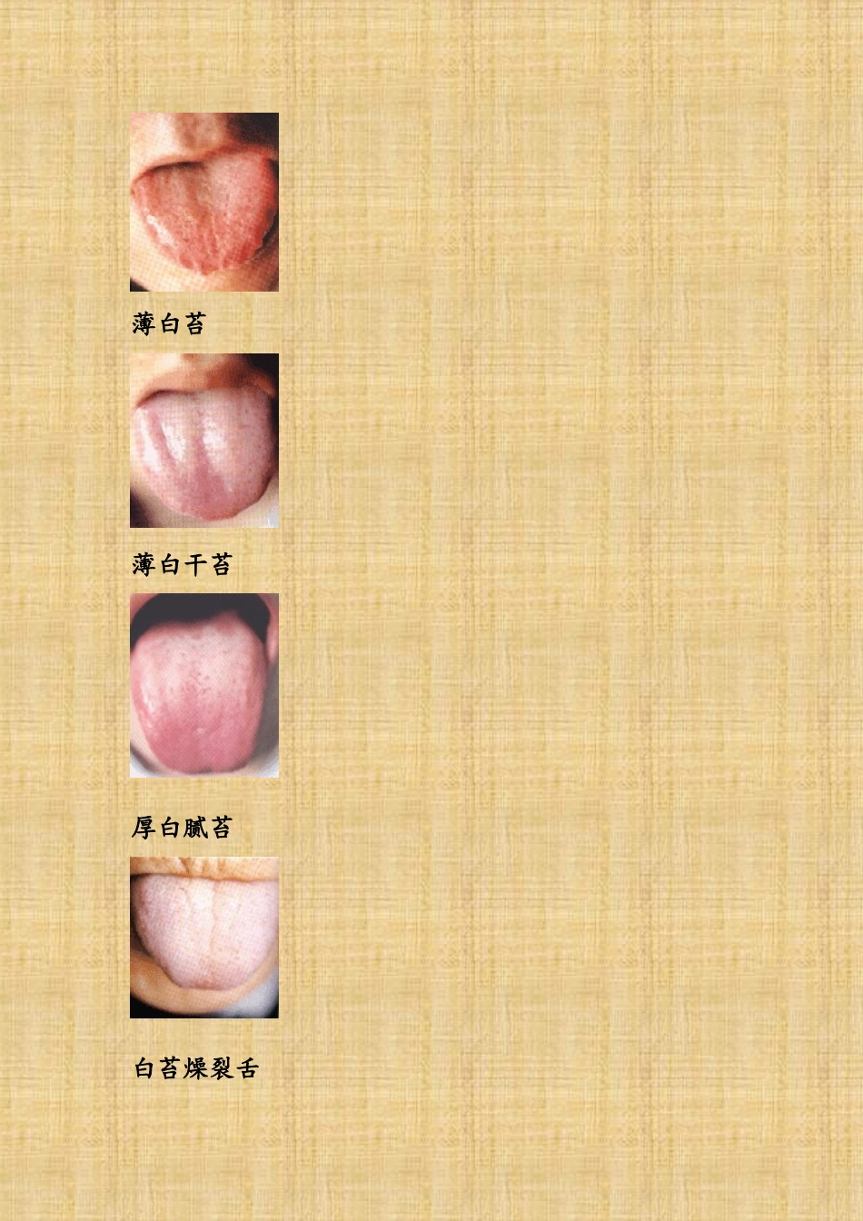 中医舌诊图解大全_第2页