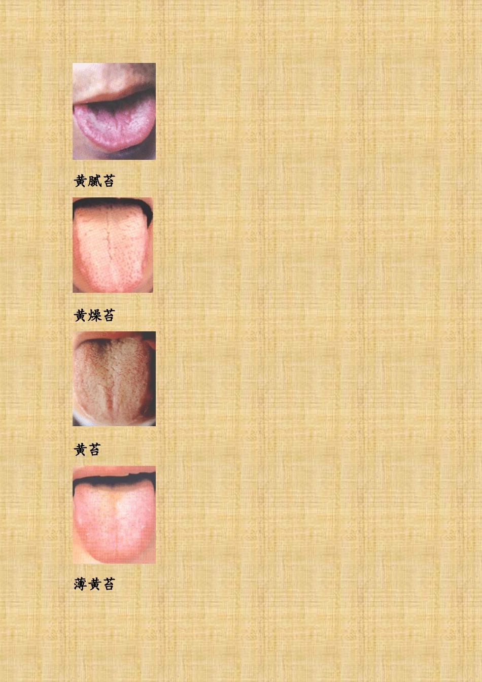 中医舌诊图解大全_第3页