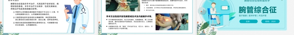 腕管综合征课件