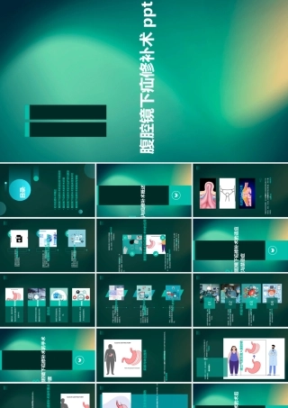 腹腔镜下疝修补术模板