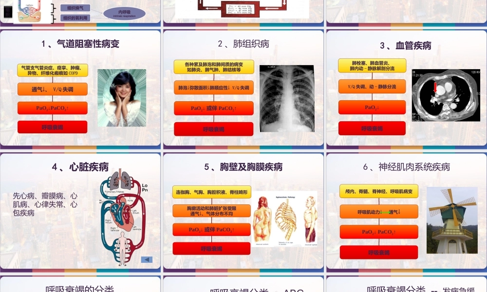 呼吸衰竭与呼吸支持