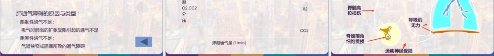 呼吸衰竭与呼吸支持