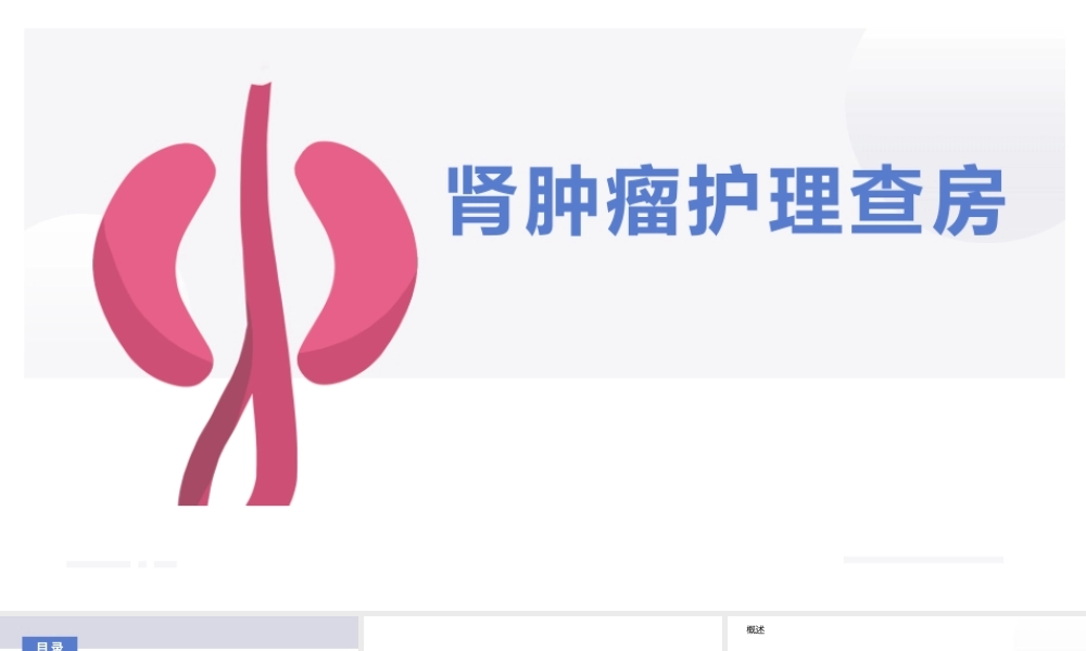 肾肿瘤护理查房综合新课件