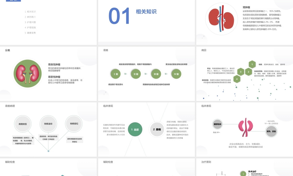 肾肿瘤护理查房综合新课件