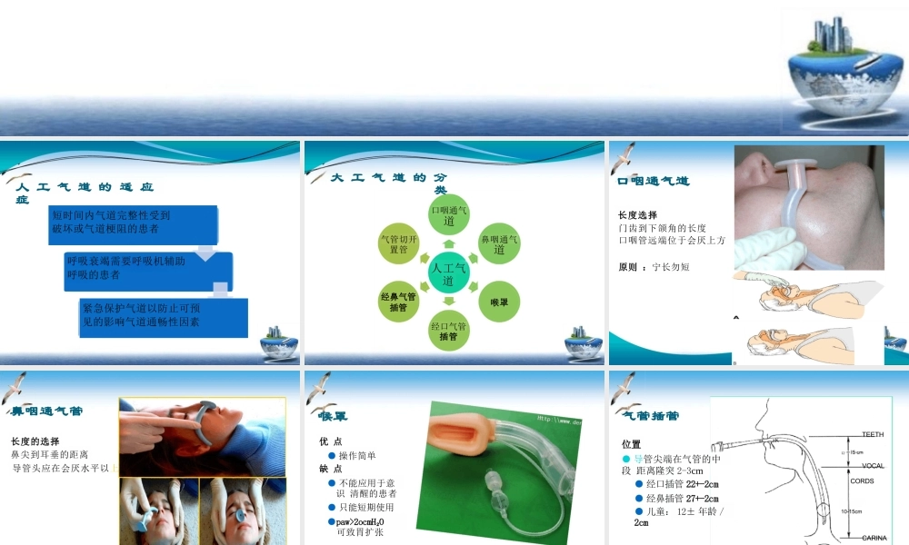 人工气道的建立和护理课件