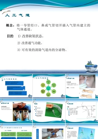人工气道的建立和护理课件