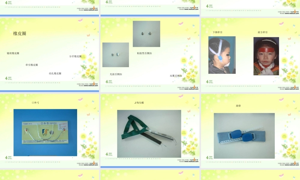 口腔正畸治疗常用材料和器械