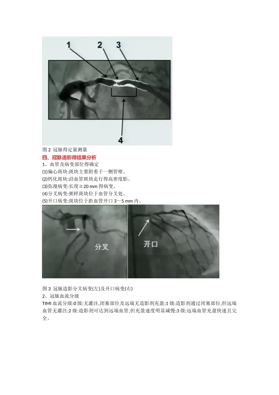冠脉造影阅片总结_第2页