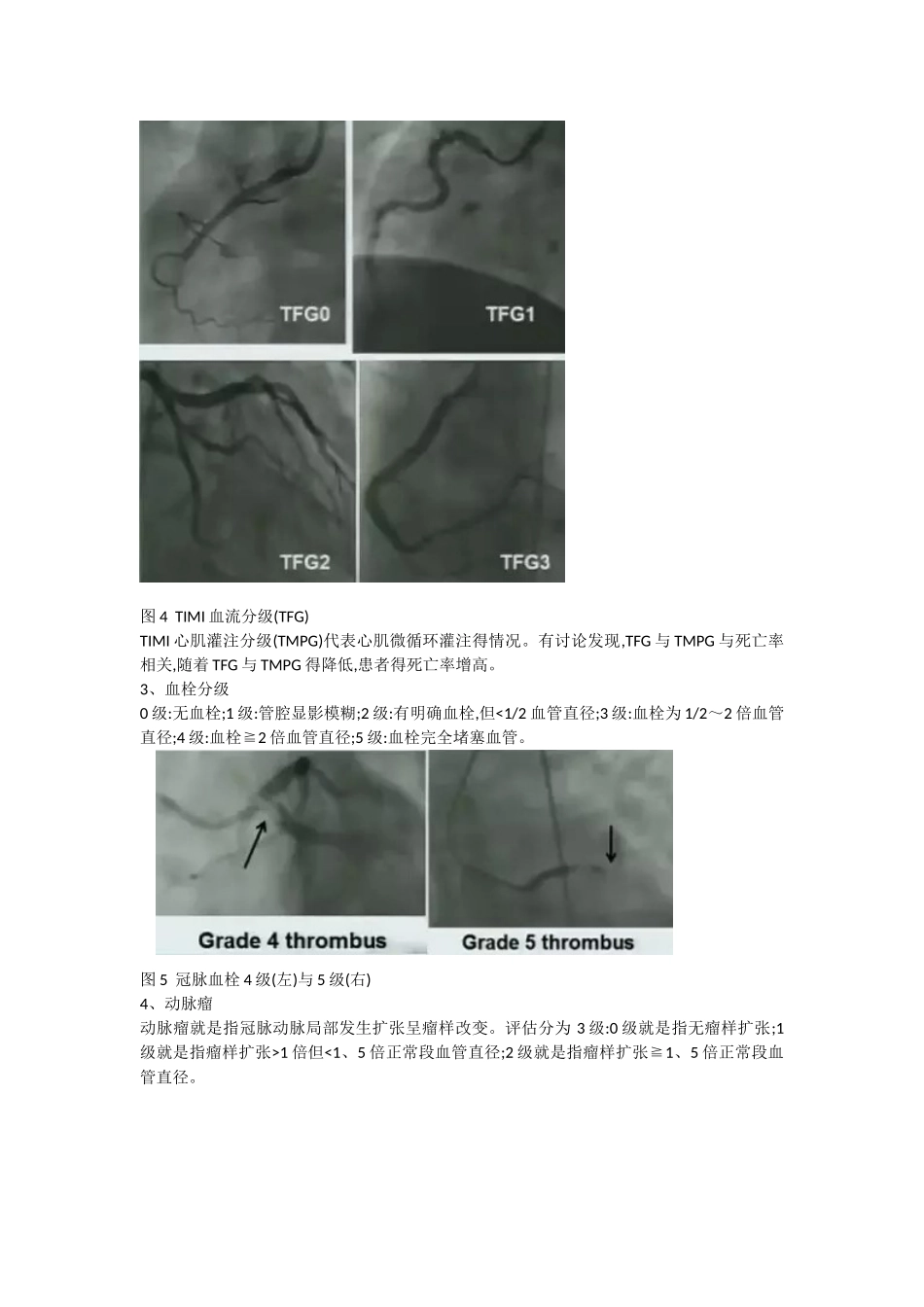 冠脉造影阅片总结_第3页