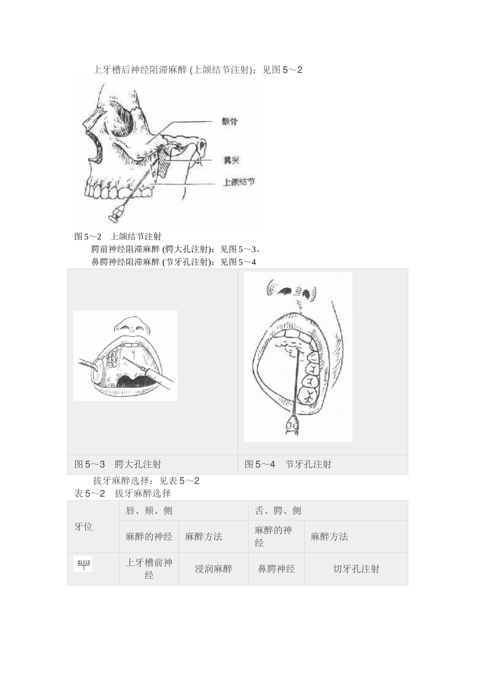 口腔局部麻醉之麻醉方法_第3页