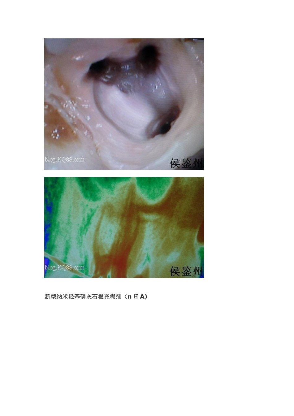 口腔常用材料_第2页