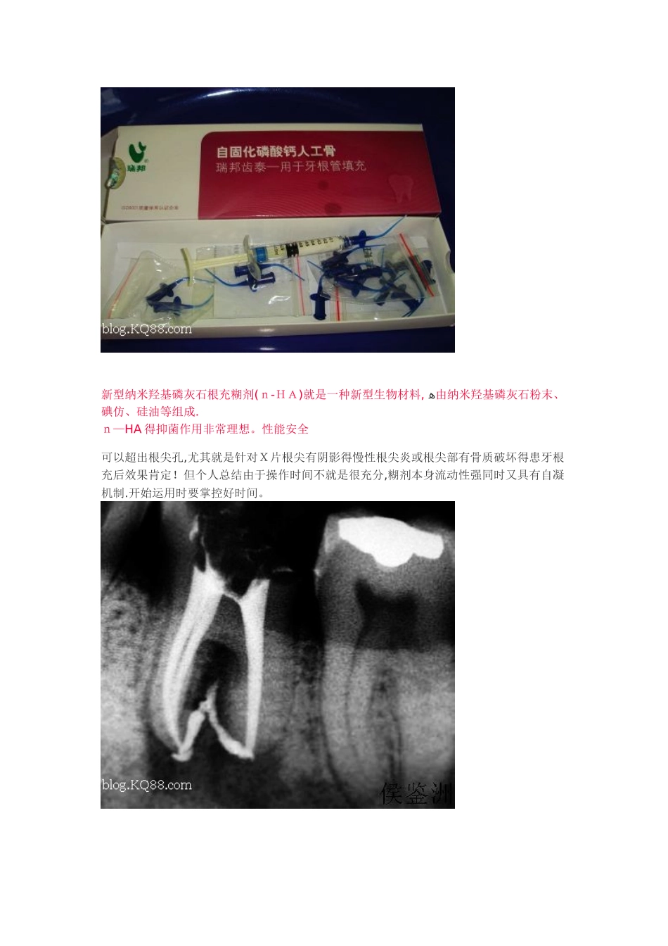 口腔常用材料_第3页