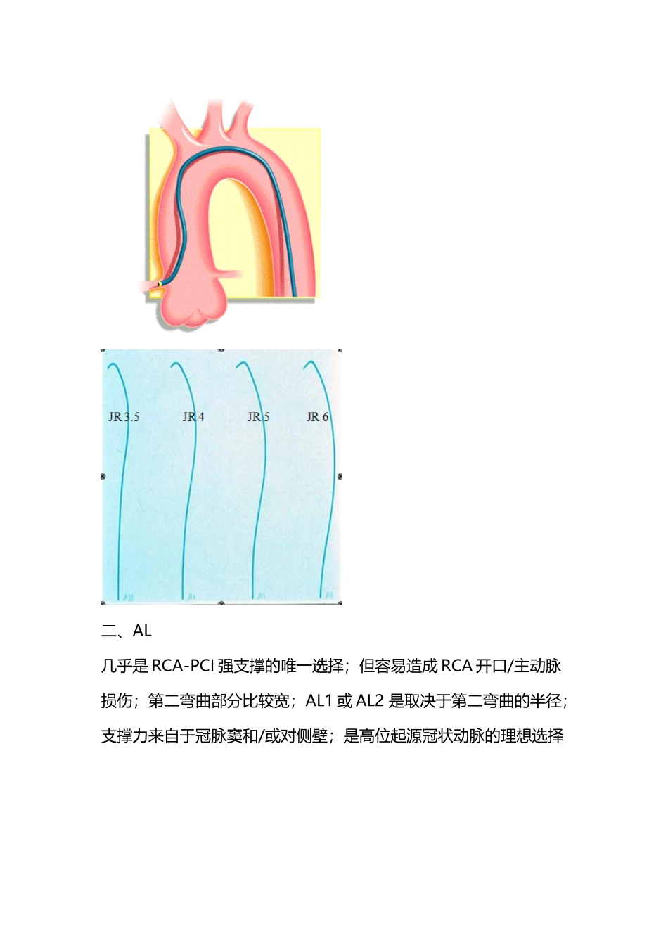 右冠状动脉指引导管的选择_第3页