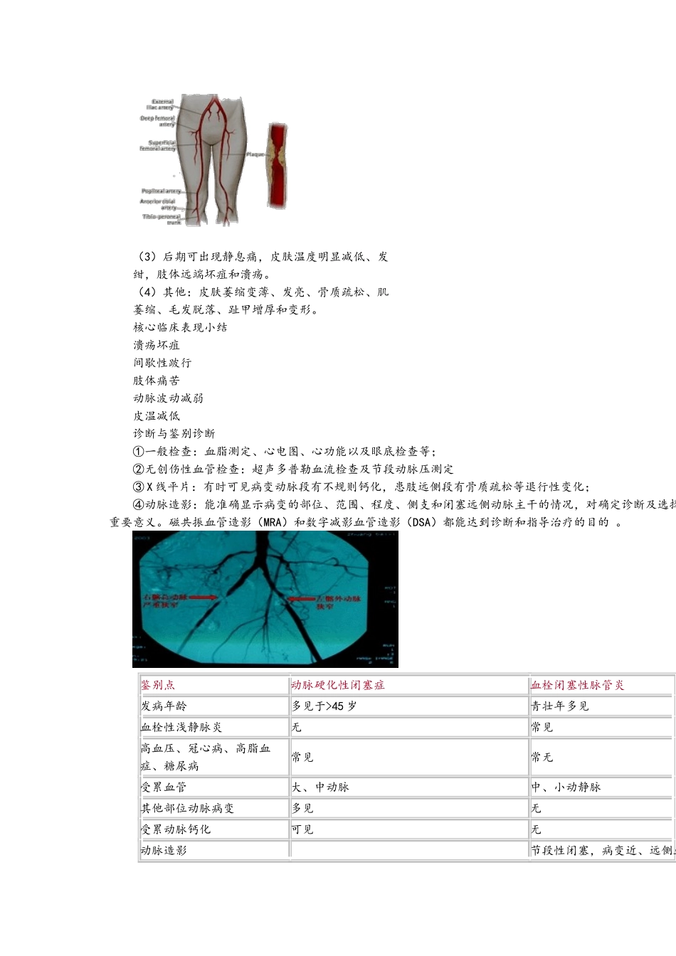 周围血管疾病_第2页