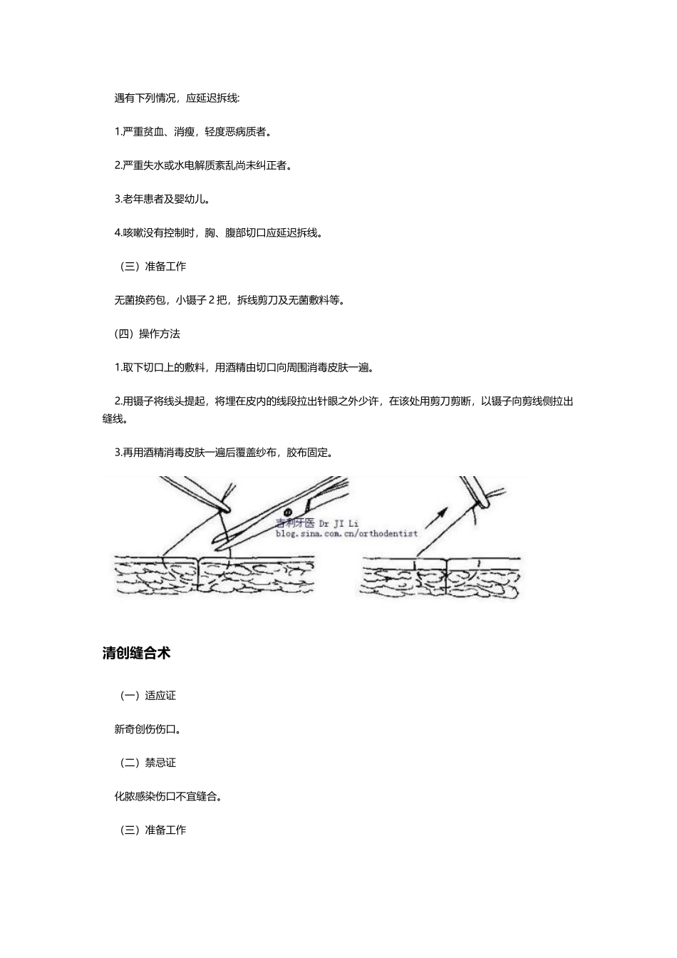 外科手术拆线时间_第3页