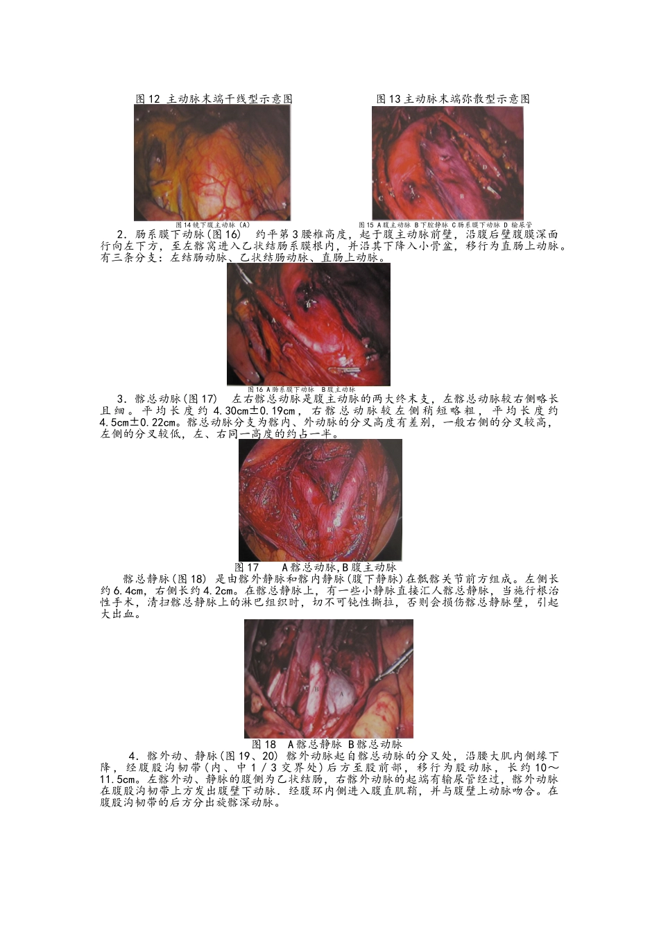 妇科腹腔镜手术相关腹部解剖_第3页