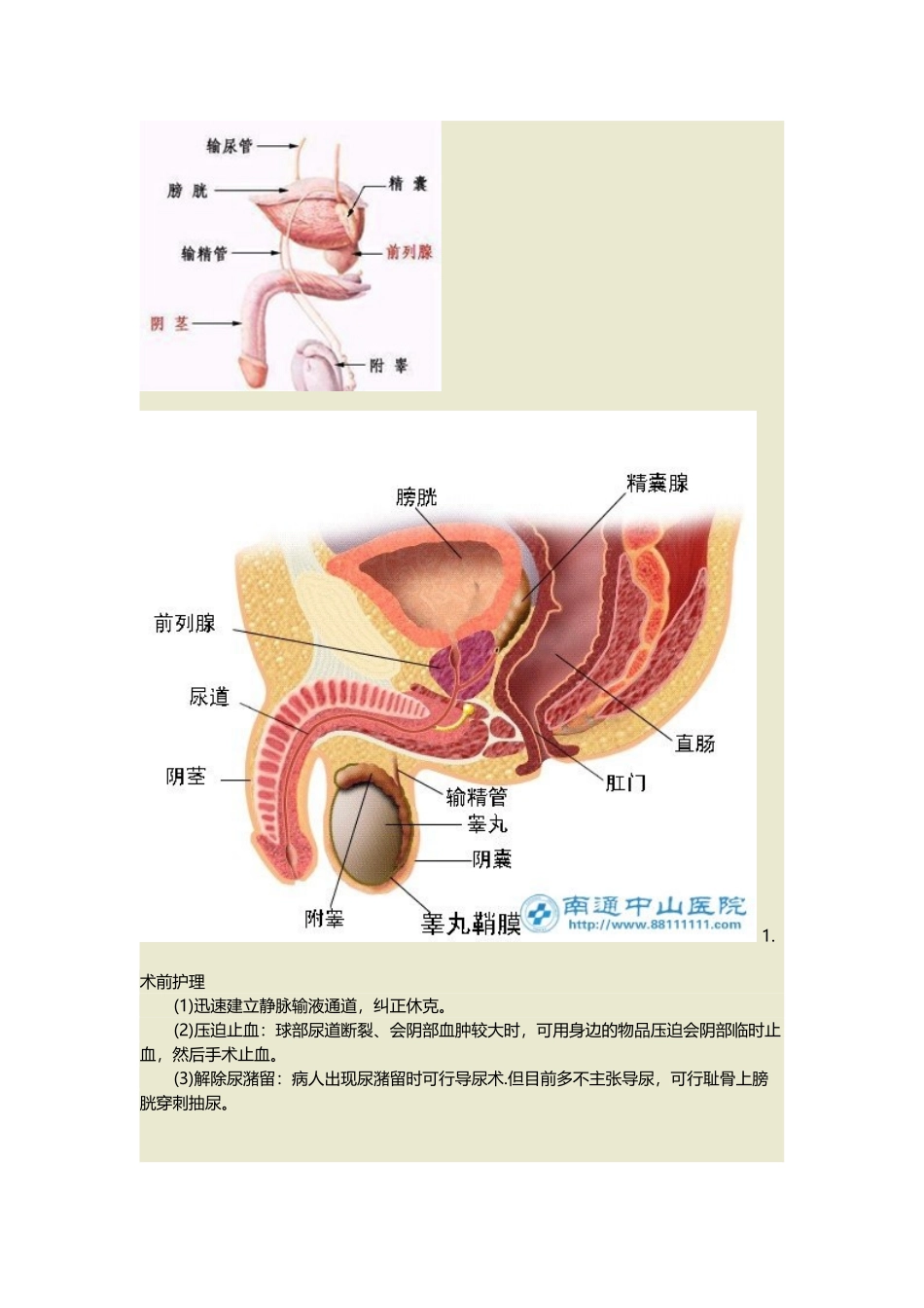 尿道损伤护理_第2页