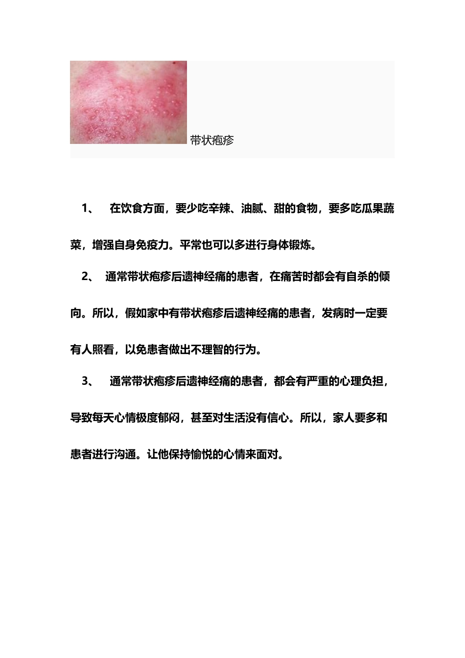 带状疱疹神经痛出院指导_第3页